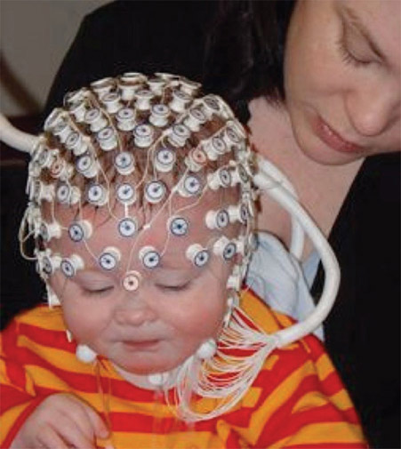 Figure 3-16 Small child wearing high-density array EEG cap with her mother.