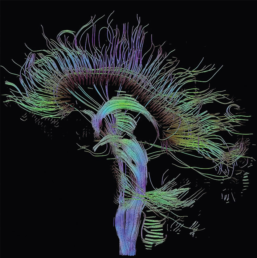 Figure 3-21 Mapping white matter connections in the brain using color coding. These represent the myelin sheath connections in the brain.
